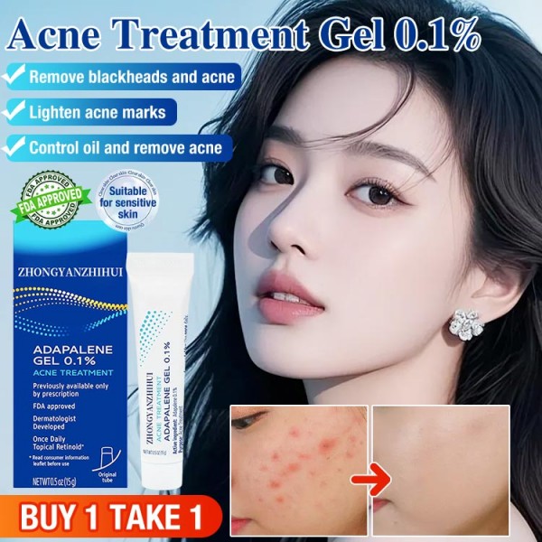 Acne Treatment Gel..
