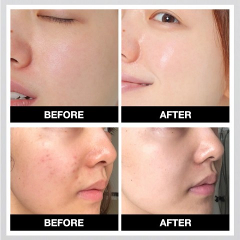 Arbutin Niacinamide Hyaluronic Acid Serum Set