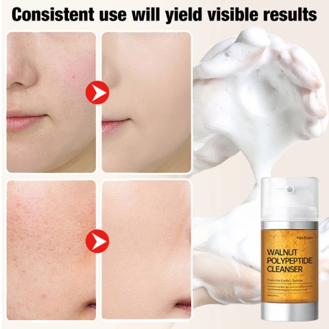 Walnut polypeptide cleanser