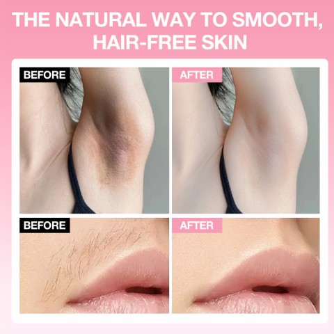 No Shave Hair Removal Cream