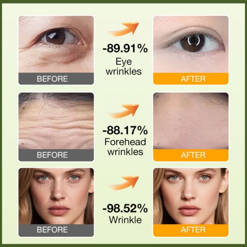 Retinol Eye Cream Retinol Eye Cream Essence Combination