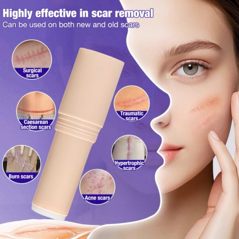 Silicone Scar Stick
