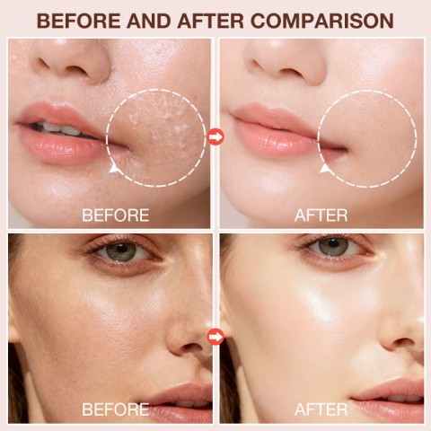 30 Seconds Micro-Bubble Mask