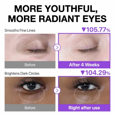 No. 9 Retinol Eye Cream