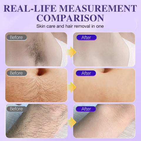 Body Hair Removal Cream