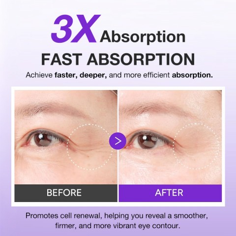 Instant Lift Eye Gel