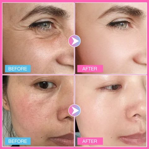 PDRN NIACINAMIDE Capsule Cream