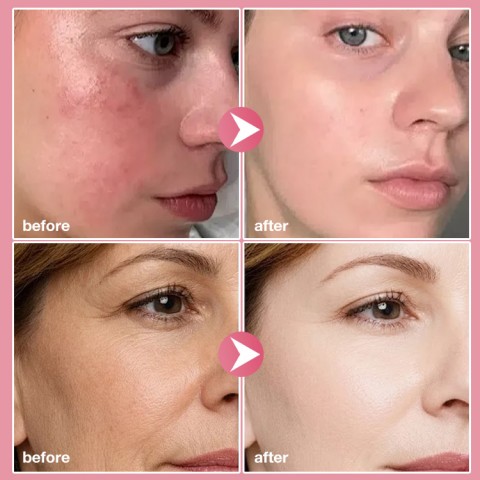 PDRN Pink Collagen Bubble Serum