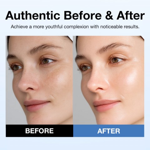 Retinal Skin Booster Serum