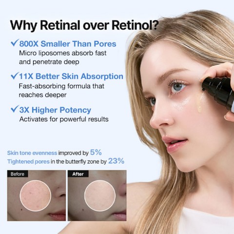 Retinal Skin Booster Serum