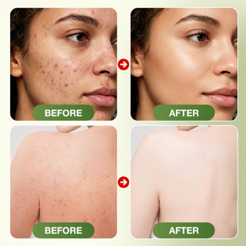 Janice jo Tea Tree Oil Anti Fungal Soap