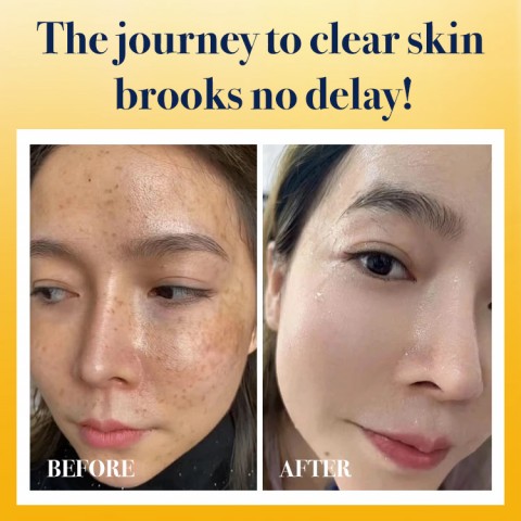Dark Spot Correcting Advanced Serum