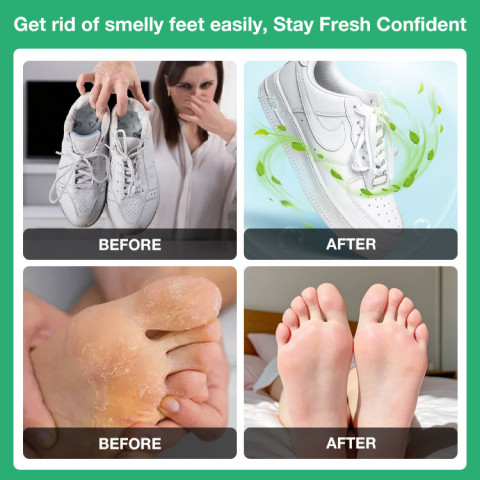 Tea Tree Oil Foot Spray