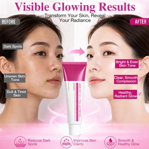 Arbutin 7% Tranexamic Acid 4% Cream 