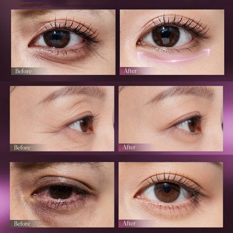 Calcium Dark Spot Eye Cream