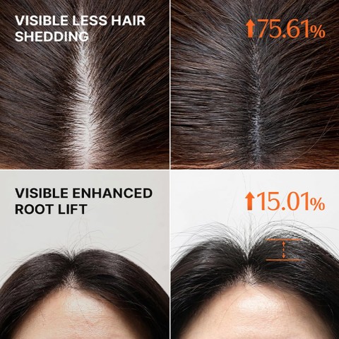 Hair Growth Serum
