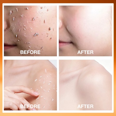 Kojic Acid Turmeric Spray