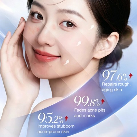 Pimples Removal Cream
