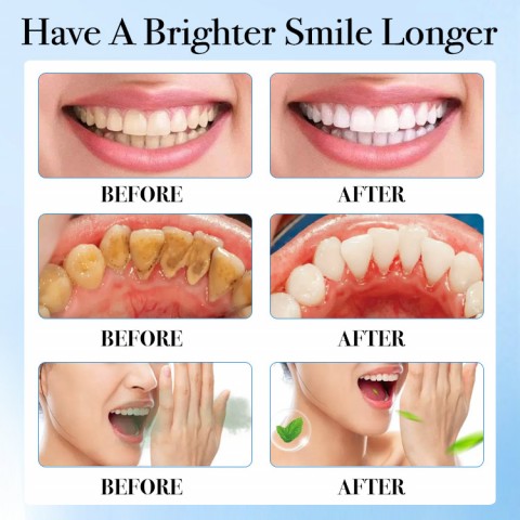 Stain-Removing Mouthwas