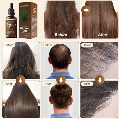 100% Organic Battanal Oil and Rosemary Hair Oil