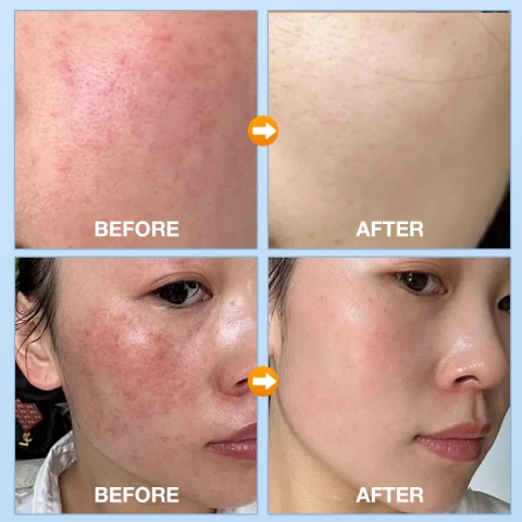 Galandutin SPF50+ Sunscreen