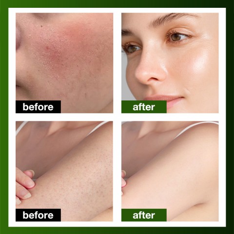 Multi-functional moisturizing and repairing cream suitable for the whole family