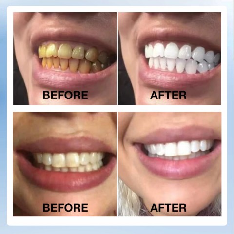 Stain-Removing Mouthwas