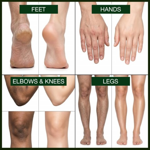 Tea Tree Oil Foot Cream