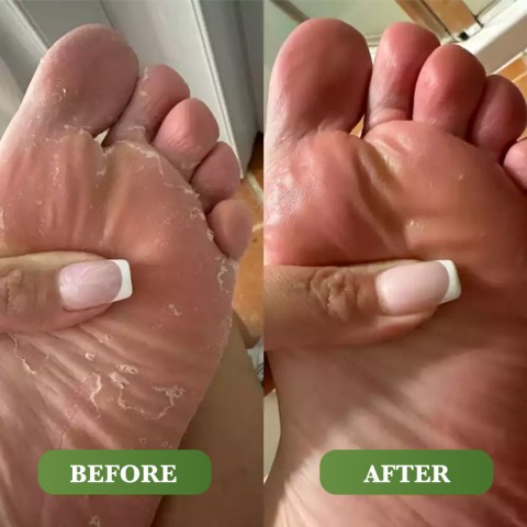 Tea Tree Soap and Foot Cream Foot Treatment Set