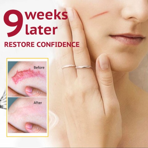 Scar Remover Gel Cream Acne Treatment Whitening Moisturizer Serum Skin Care
