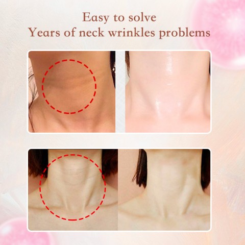 White Bandage Anti-Wrinkle Neck Cream