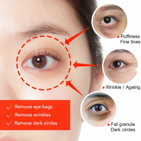 Astaxanthin caviar eye cream-Anti Aging Wrinkles Remove Dark Eye Circle Eye Care