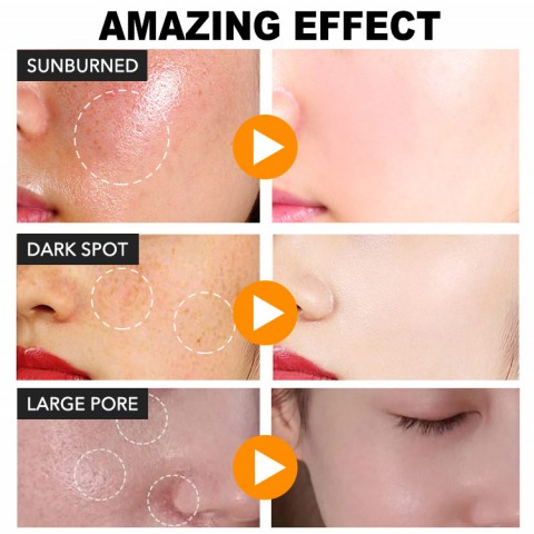 VC Whitening Gloss Skin Care Combo