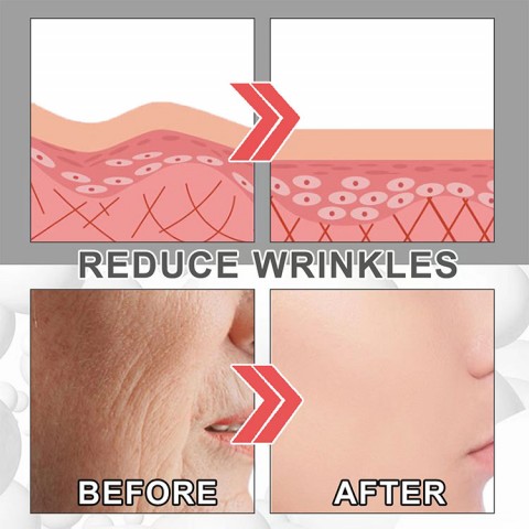 Collagen Whitening Anti-Wrinkle Cream - Replenish collagen and promote skin regeneration