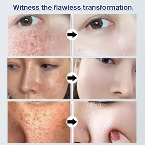 Japanese Technology Whitening Freckle Cream