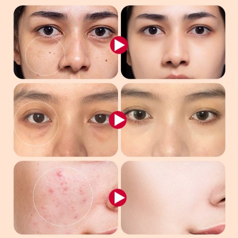 Korea Long-lasting waterproof concealer-Cover dark circles,acne marks,scars-puff as a freebie