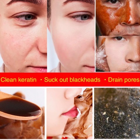 Blackhead Removal Cleansing Mask
