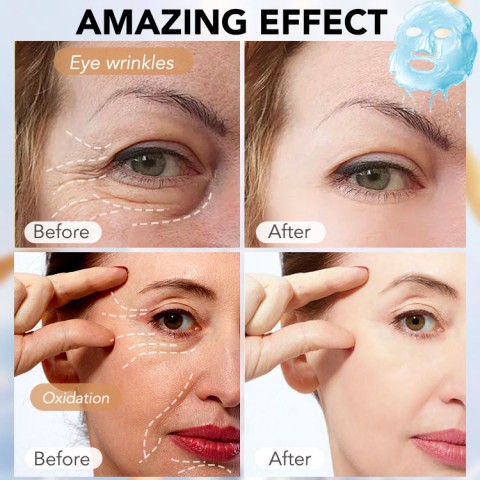 ELLEN ELLA Triple Retinol Niacinamide Anti Aging Whitening Facial Mask Set 5pcs Recommend By Devikustinaw