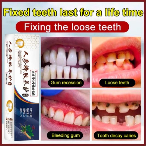 Loose Teeth Care Toothpaste