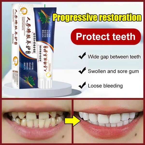 Loose Teeth Care Toothpaste..