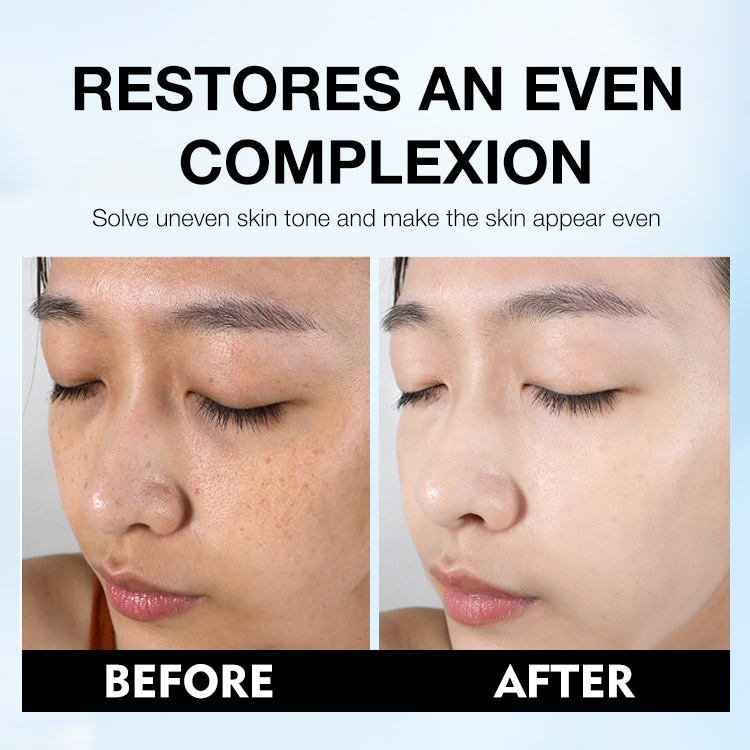 Heroes Day Promotion –Dark Spot Corrector Lotion-“Erase” and fade age spots without harsh chemicals or lasers-Reduce sun spots, dark spots, and hyperpigmentation