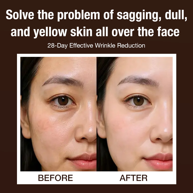 Christmas Sale Free Shipping - Ganoderma lucidum Anti-wrinkle Rejuvenating Serum - Fade fine lines/Deeply repair/Moisturizing & Firming skin - 28-Day Effective Wrinkle Reduction