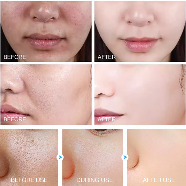 Marys Month promotions-Purifying Enzymes Exfoliating Gel-Time to say goodbye to dull skin! Say Hello to Smooth, Radiant Skin!
