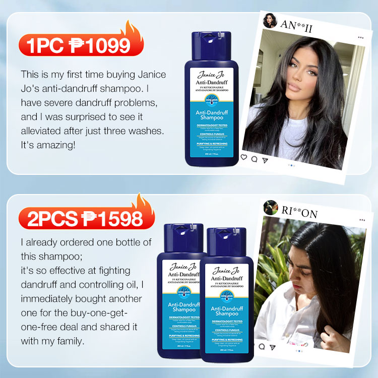 Kadayawan Festival Promo-The second is only 499 pesos-1% Ketoconazole Anti-Dandruff Oil Control Shampoo-Say goodbye to dandruff and hello to confidence