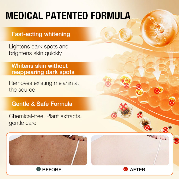 Heroes Day promotion- Add 200P for Second Piece -JaniceJo Lemon Kojic Acid Turmeric Whitening Soap Bar for Face and Body - Get cearer, brighter, healthier-looking skin every wash!