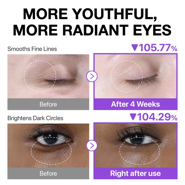Mothers day promo Buy 1 Take 1 - No. 9 Retinol Eye Cream - Korean Trendy - Smooth wrinkles/Deep hydration/Enhance elasticity - One shot to make you younger