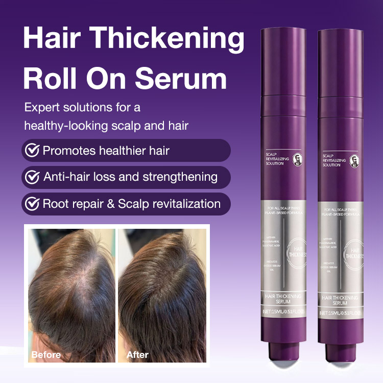 Mid-year Promo Buy 1 Take 1 to Save ₱599 - the No. 1 Korean Hair Thickening Roll-On Serum Reduces Hair Shedding - Targets Thinning Areas- Nourishes the Scalp Support fulle-Perfect for all scalp types