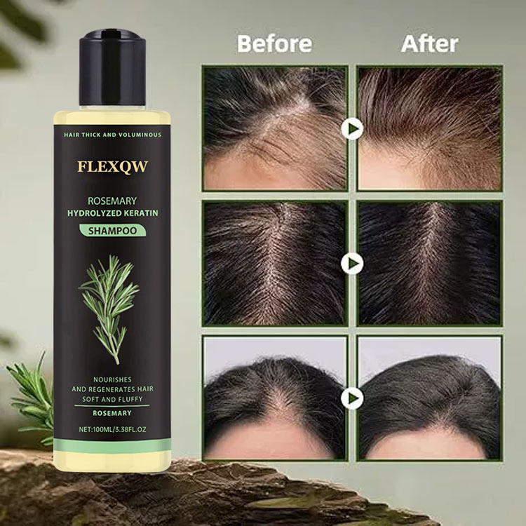 Womens Day Promo Buy 1 Take 1 - Rosemary Shampoo - Boost Hair Growth, Control Oil , Dandruff, Soothe Scalp lritation and Restore Shine