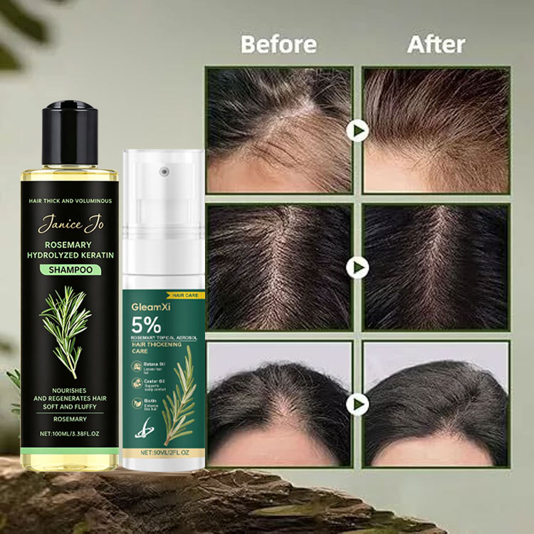 Mothers day promo Buy 1 Take 1 - Rosemary Shampoo and Hair Spray - Boost Hair Growth, Control Oil , Dandruff, Soothe Scalp lritation and Restore Shine