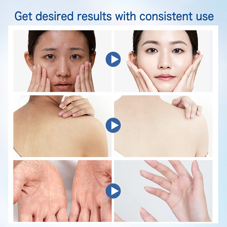 Valentines Day Sale to Save 149 Pesos now - Best seller in japan - Vaseline Peach Moisturizing Stick- Moisturizing, whitening, wrinkle removal For lips, face, neck and body